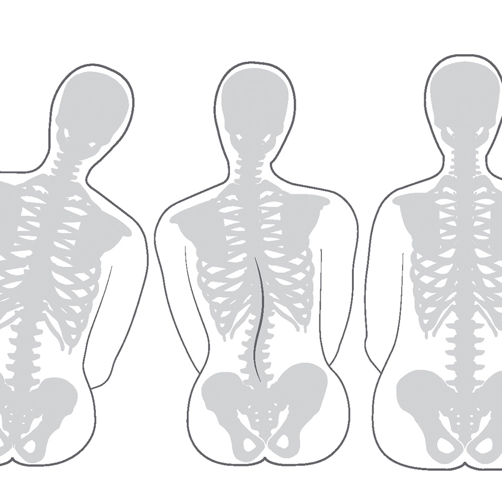 Shape for the Individual